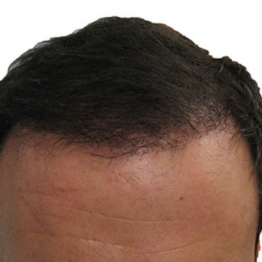hair-after